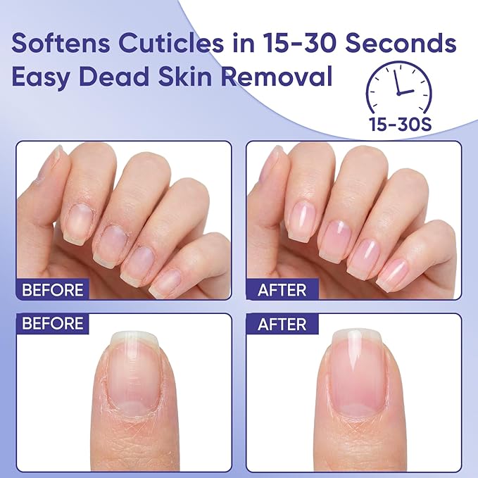 Ceramic Cuticle Pusher & Oil Pen + Cuticle Remover Gel – Gentle Nail Care Kit, 2ml Scent-Grape Nourishing Oil, 1 fl. oz with Jojoba Oil & Vitamin E for Dry, Damaged Nails (Grape3.0&Gel)