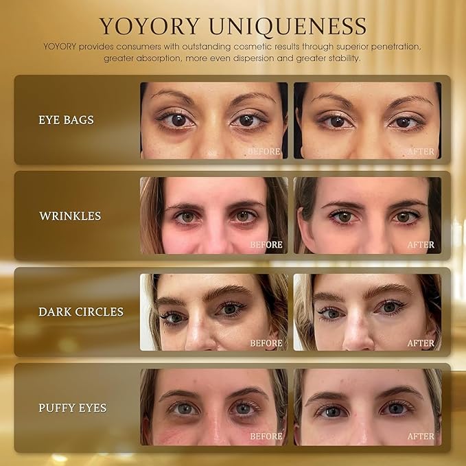 Under Eye Patches Masks - for Dark Circles, Puffy Eyes, Fine Lines, Wrinkles, Eye Bags Treatment with Collagen and Hyaluronic Acid,Anti-Aging & Cooling, Moisturizing (60 Pcs) GOLD2