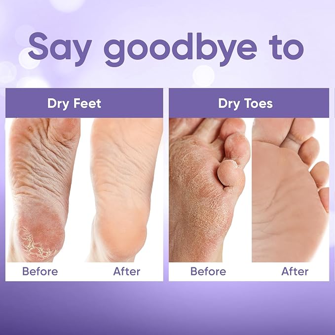 CÉLOR Foot Peeling Mask for Dry Cracked Feet | Foot Mask to Exfoliate Rough, Cracked, Dry Feet, Calluses for Soft Baby Feet Results | Made with Aloe Vera Extract for Women & Men (2 Pairs) | Lavender