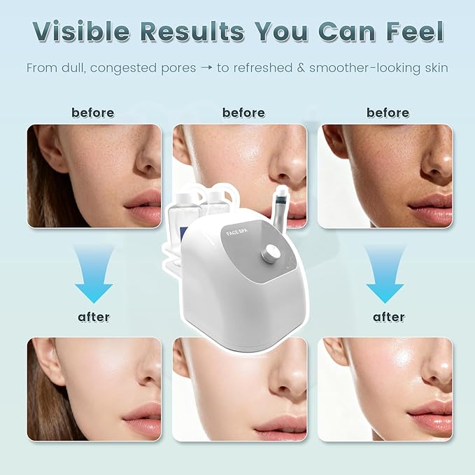 Hydrogen Oxygen Facial Machine, Hydro Facial Machine & Hydrodermabrasion Machine for Skin Care, Facial Vacuum Pore Cleaner, Hydro Dermabrasion Machine for Deep Cleansing & Hydration, Home Use