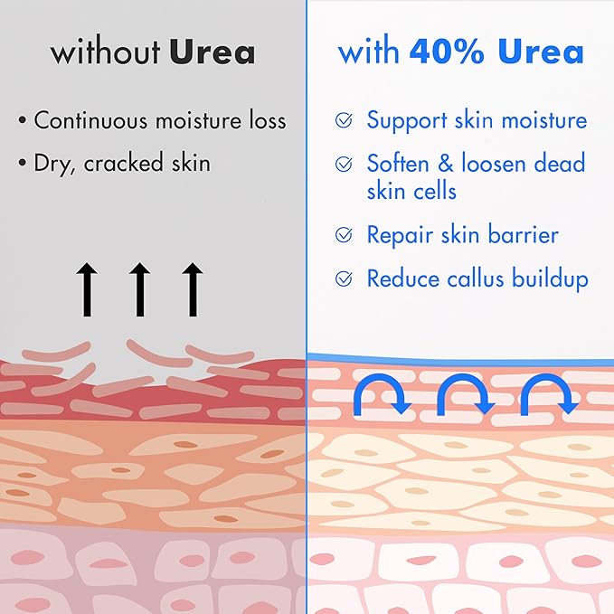 Ebanel Urea Cream 40% plus Salicylic Acid 2%, Foot Cream for Dry Cracked Heels Feet Knees Elbows Hands, Foot Dead Skin Cuticle Callus Remover Toenail Softener, Keratolytic Skin Barrier Repair, 6-Pack