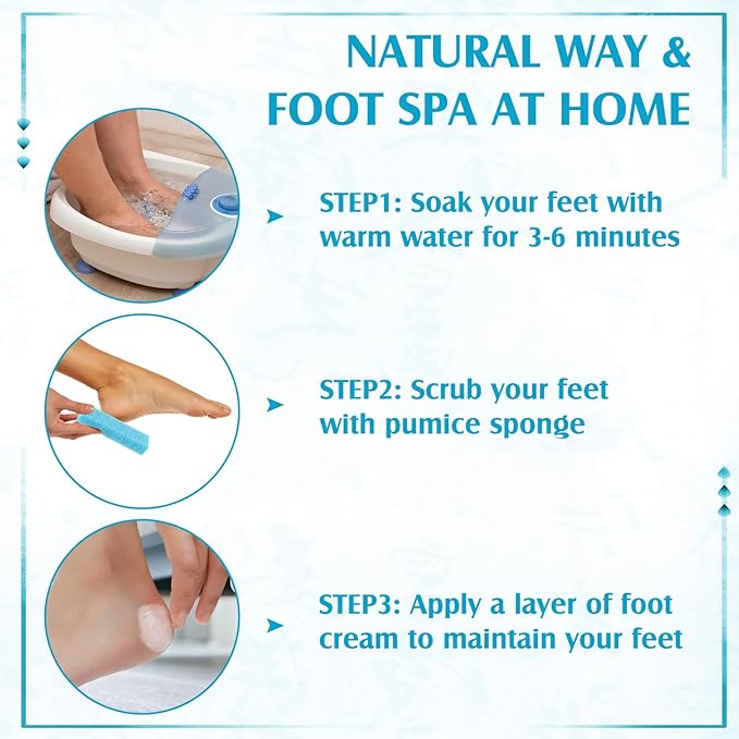 Batiyeer 100 Pcs Pumice Stone for Feet Scrubber Dead Skin Disposable Pedicure Pumice Stone Foot Shower Scrubber for Heel Cuticle Callus Remover Bath Spa (Sky Blue)