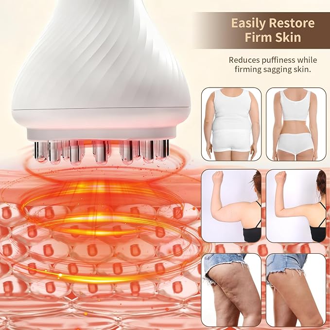 Body Sculpting Machine, Lymphatic Drainage Massager & Anti Cellulite Massage Tool, Helps Reduce Stretch Marks & Cellulite, Pain Relief Devices for Legs, Arms & Belly, Body (White)