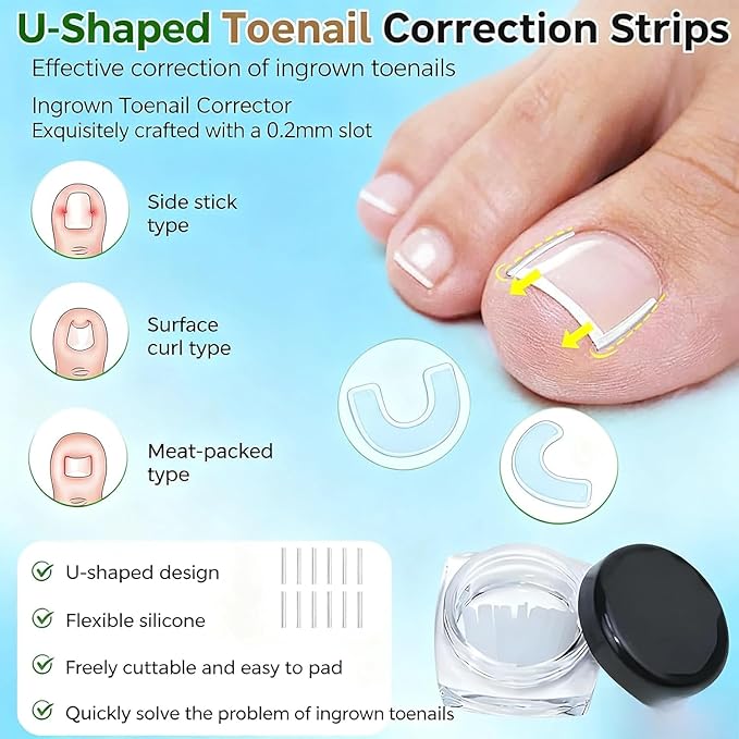Ingrown Toenail Corrector Set with Treatment Tools & Correction Strips, Professional Pedicure Tools for Feet – Painless Ingrown Toenail Treatment and Home Care Solution for Men and Women (1Set)