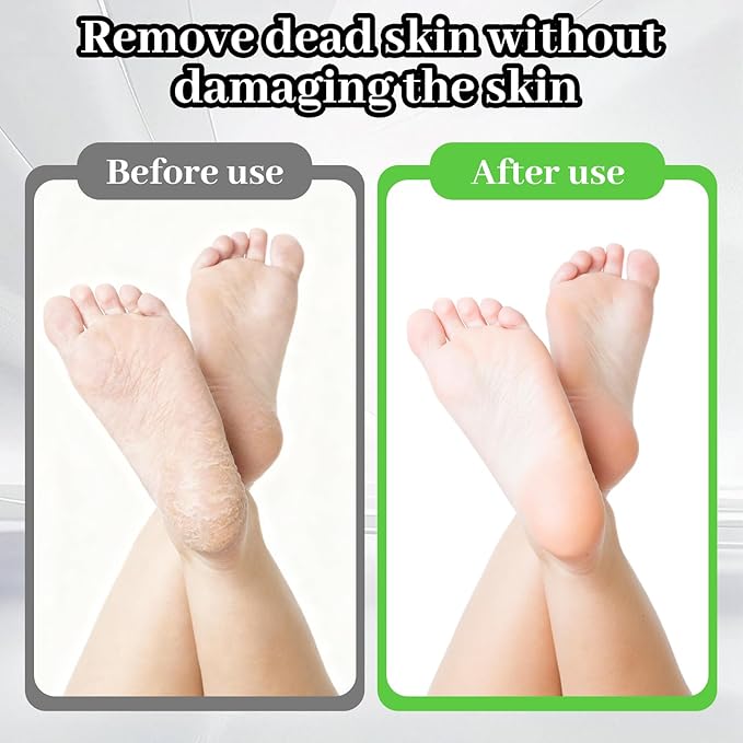 Foot File - Stainless Steel Pumice Stone Foot Rasp File with 20 Replacement Pads - Dual Grit Feet Scrubber Callus Remover for Hard Skin Care Cracked Skin Corns Callus Remover