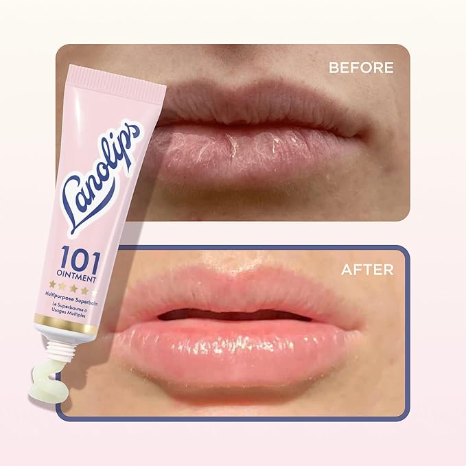 Lanolin 101 Multipurpose Ointment - Lanolin Lip Balm & Healing Ointment for Skin Barrier Repair - Moisturizer for Dry Lips, Cuticles & Elbows - No Petroleum Formula - Original Superbalm (0.52 oz)