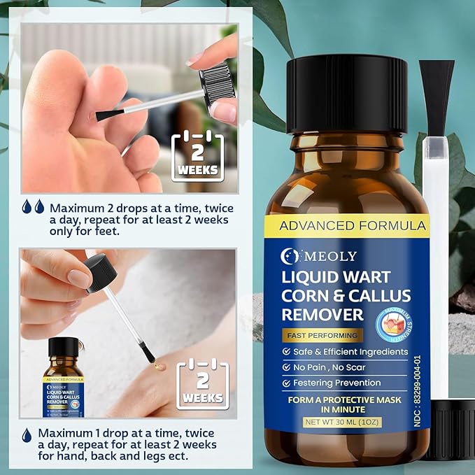 MEOLY Fast-Acting Wart Remover Freeze Off : Salicylic Acid Wart Remover for Plantar Wart, Corn Freeze Off Fast-Acting for Men and Women 30 ML