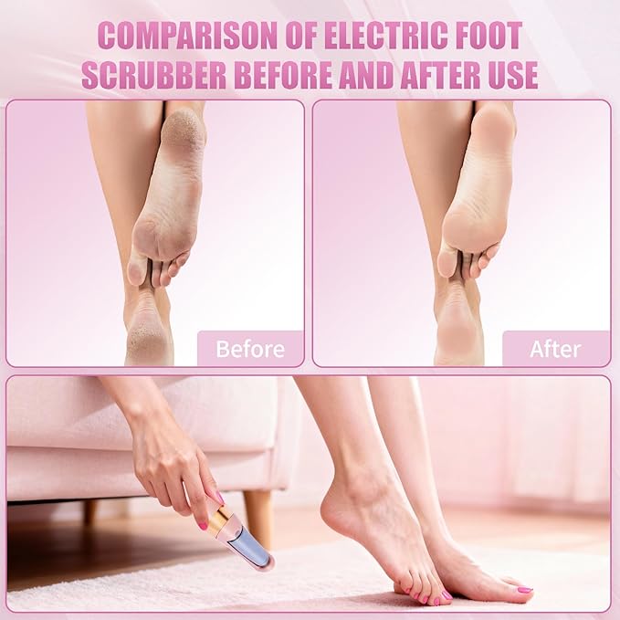 Pedicure Tool, Foot Callus Remover, Electric Pedicure Set, Foot Care, Removes Rough Dead Skin on The Feet, Making Your Feet Smooth. (Pink)