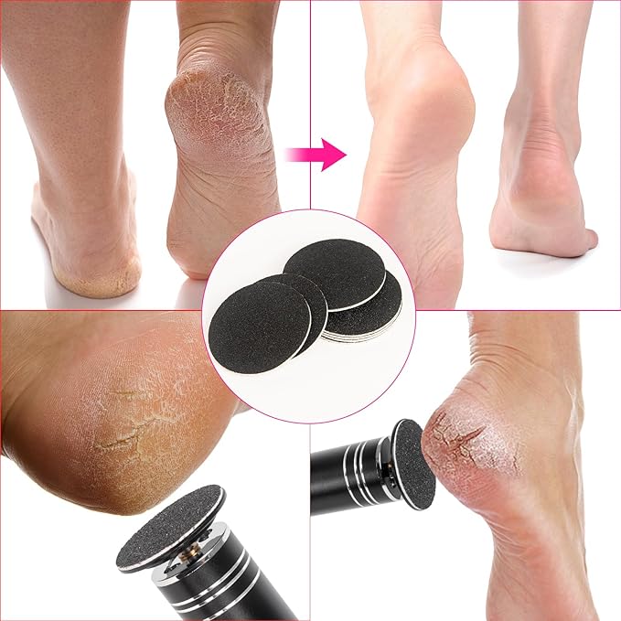 Krofaue 60 PCS Replaceable Sandpaper Discs - 80 & 100 Grit Pad Refills for Electric Foot File Callus Remover - Dead Skin and Calluses Removal