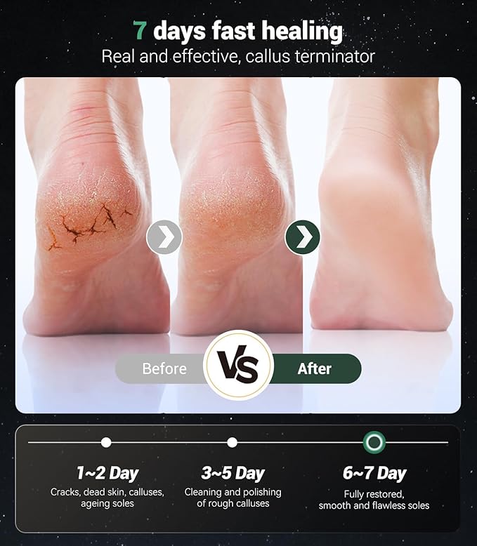 5-in-1 Professional Electric Callus Remover(Portable & Foldable), Removes 99.92% of Calluses in 3 Mins, Rechargeable Foot File Pedicure Kits with 10 & 40 Grit Pads for Soft Smooth Feet, Gunmetal Gray