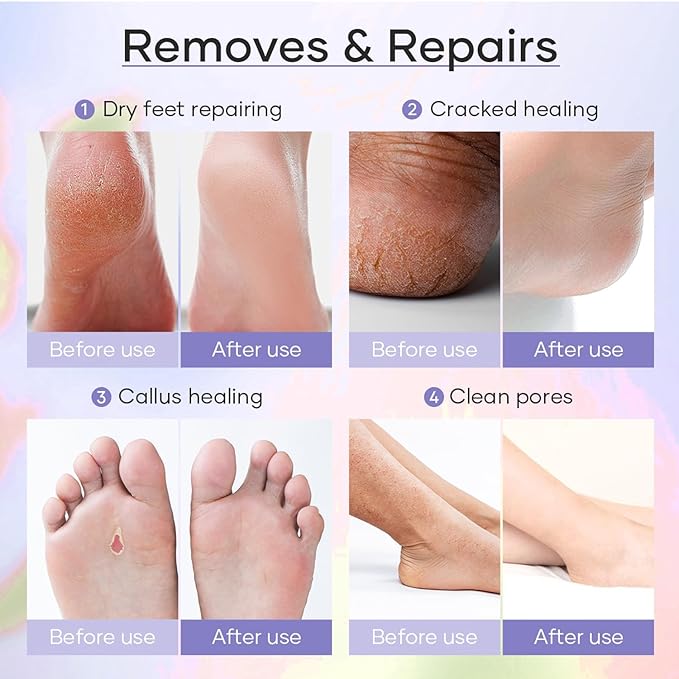 Deluxe 6 Step Pedicure Kit with Massage Oil Candle, Epsom Salt, Callus Remover Gel, Collagen Mask & Shea Butter Lotion + Disposable Pedicure Kit, Liner & Slippers (03 Sets, Milk & Honey)
