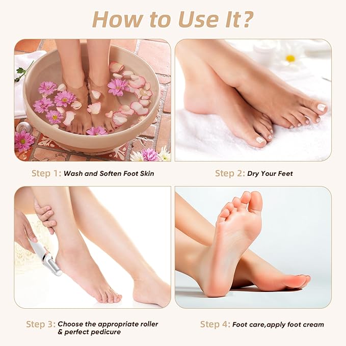 Electric Foot Callus Remover, Electronic Foot File, Portable Electric Callus Remover for Feet, Pedicure Tools for Dead Skin Calluses (White)