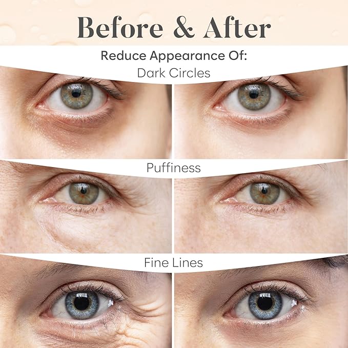 BLOOMORA Caffeine Under Eye Patches (20 Pairs) - Dark Circles & Puffiness Care - Hydrating Caffeine Eye Mask