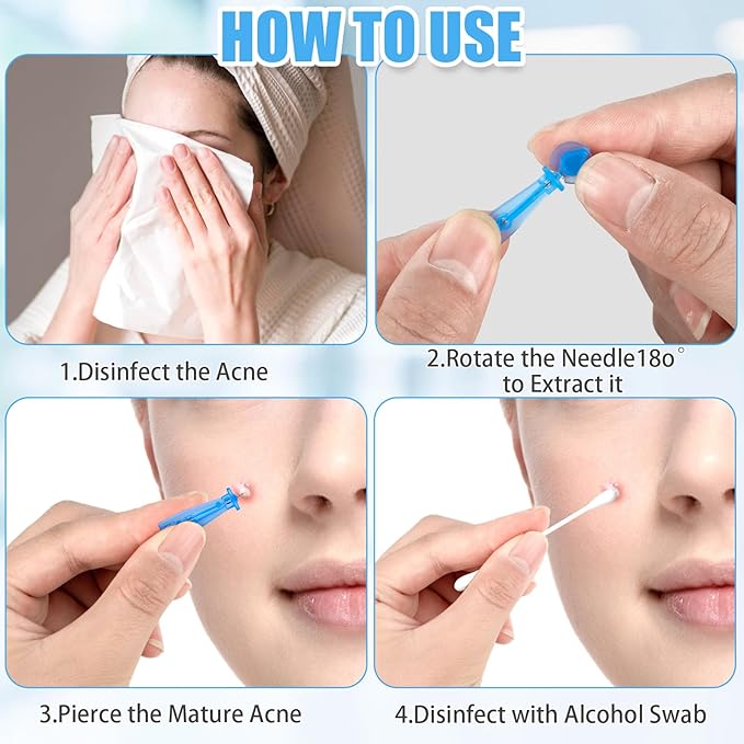 200Pcs Sterile Needles for Pimples, Disposable Acne Needle Effective Blemish and Blackhead Removal Tools for Clear Skin