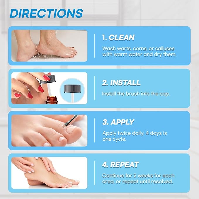 Aemerry Corn Removers for Toes Foot: Liquid Salicylic Acid 17% Corns Calluses Removal Extra Strength, Fast Acting Corn Remover for Feet Fingers. 30ml