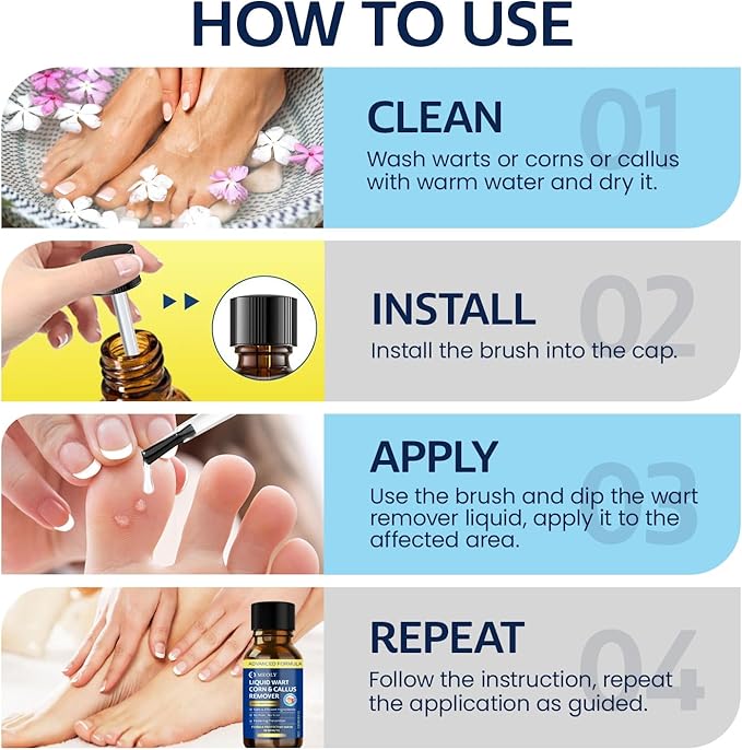 MEOLY Fast-Acting Wart Remover Freeze Off : Salicylic Acid Wart Remover for Plantar Wart, Corn Freeze Off Fast-Acting for Men and Women 30 ML