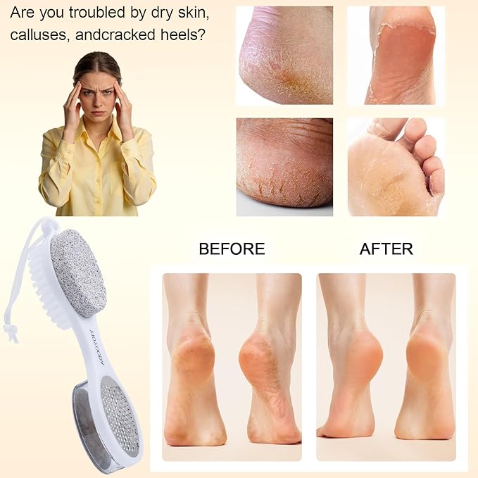 Foot Scrubber Brush with Pumice Stone for Feet 5-in-1, 2Pcs Foot File Callus Remover, Stainless Steel Feet Scraper, Cleaning Brush & Sand Paper Debris Catcher, Multi Purpose for Home Foot Care, White
