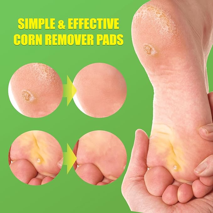 WABRINY Maximum Strength Corn Removers Pads for Feet and Toes, Fast Effective Foot Corn -YD