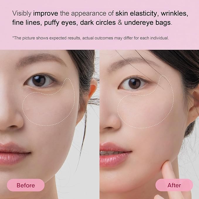 TEREZ & HONOR Peptide Collagen Hydrogel Eye Patches - 24 Pairs Korean Under Eye Masks for Puffy Eyes, Dark Circles, Wrinkles & Undereye Bags - Firming, Hydrating, Travel & Gift Ready Skincare Eye Pads