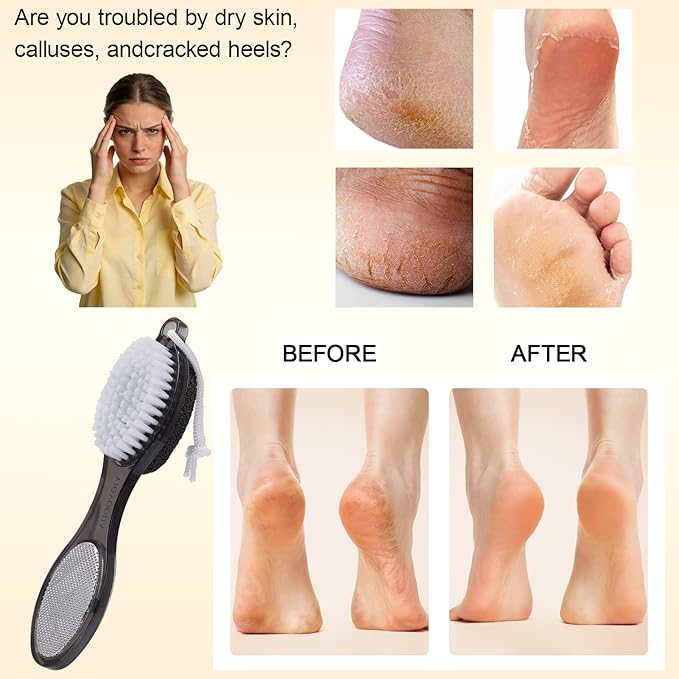 Foot Brush and Pumice Stone for Feet, 4-in-1 Foot File Callus Remover, Feet Scrubber Brush, Rasp and Sand Paper Pedicure Tools, Multi Purpose for Home Foot Care, 2 Pcs, Clear Black and Pink