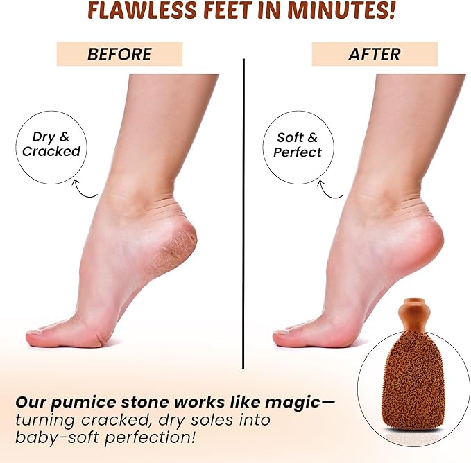 POHS Rectangular Pumice Stone – Callus Remover & Exfoliator for Feet & Body, Foot Scrubber for Shower, Natural Pumice Stone for Smooth Skin