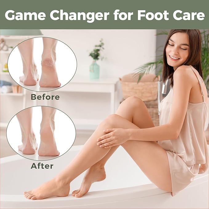 Foot File Foot Scrubber Pedicure - Callus Remover for Feet Easkep Professional Grater Rasp Foot Scraper Corns Callous Removers Cracked Dead Skin Remover for Dry and Wet Feet (Grey Green)