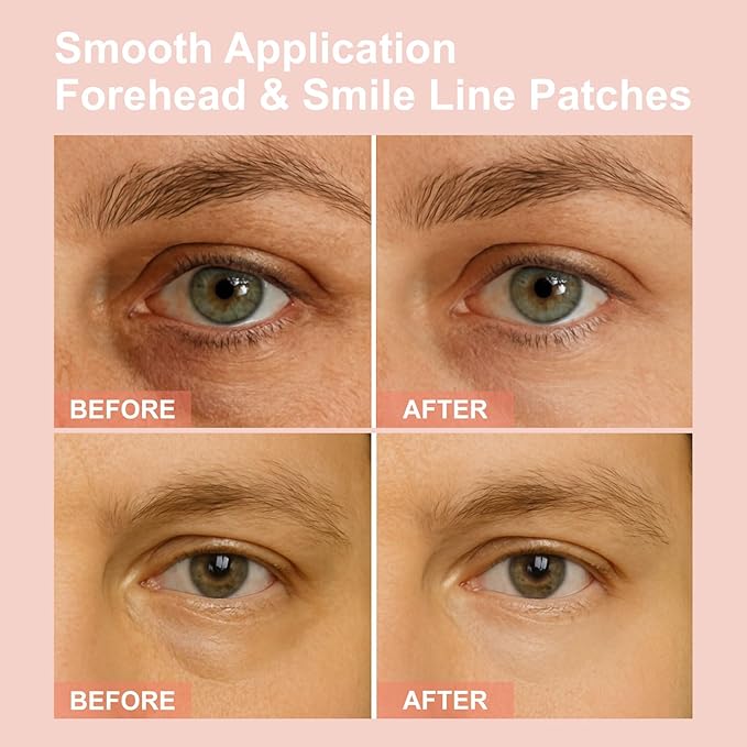 Micro Eye Patches, Under Eye Patches for Puffy Eyes, Dark Circles & Fine Lines, Deeply Hydrating Anti-Wrinkle Patches, Smooth Application Forehead & Smile Line Patches (2)