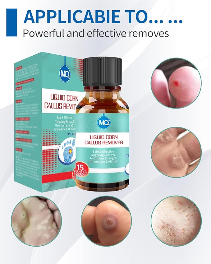 MQ Professional Corn & Callus Remover Liquid for Feet & Toes – Fast Acting for Corn Removal, Hard Skin & Dead Skin – Includes 15ML Solution + 15 Cushions + 10 Swabs – Effective Foot Care Solution