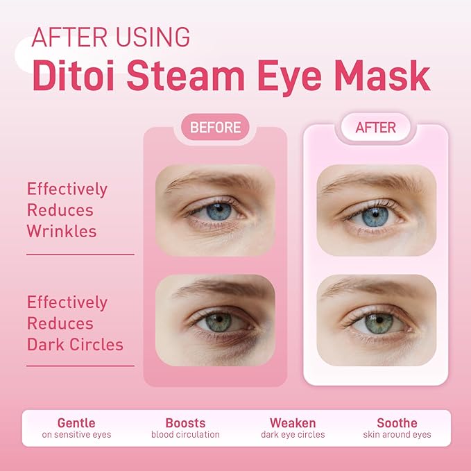 Ditoi Steam Eye Mask, Heated Eye Mask for Dry Eye Relief,Warm Compress with Hyaluronic Acid,Christmas Stocking Stuffers,Travel Essentials & Relaxation Gifts,Rose 20 Packs