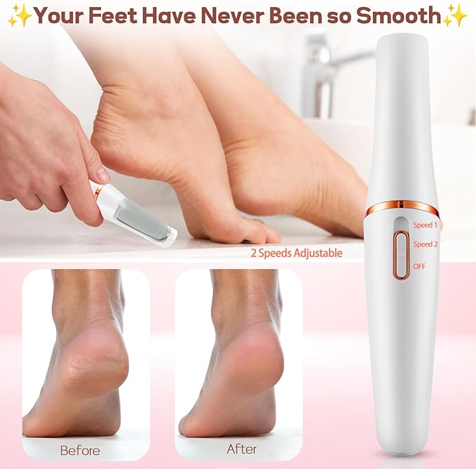 ZABOUL Electric Foot Callus Remover Rechargeable Portable Electric Foot File Pedicure Tool Kit, Smooth Pedicure Wand for Feet Care, Removes Dry Hard & Dead Skin, Ideal Gift