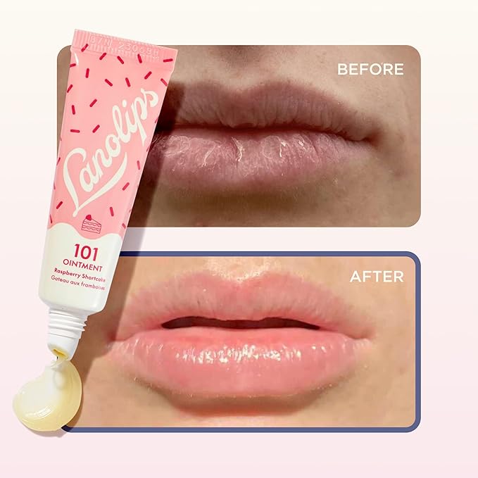 Lanolin 101 Multipurpose Ointment - Lanolin Lip Balm & Healing Ointment for Skin Barrier Repair - Moisturizer for Dry Lips, Cuticles & Elbows - No Petroleum Formula - Raspberry Shortcake (0.35 oz)
