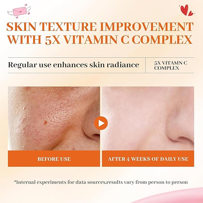 Vitamin C Face Toner 130ml, HONLINK 5X Vitamin C Complex with Niacinamide & Hyaluronic Acid, Hydrating & Balancing Toner for Daily Skincare, Valentine’s Day Gift for Her