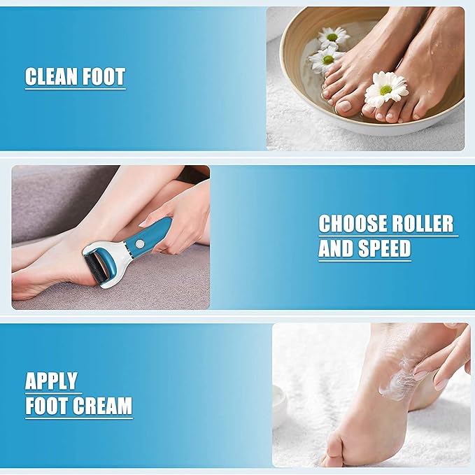Electric Foot File Callus Remover Professional, 2-Speed Rechargeable Pedicure Tool for Remove Calluses, Dry, Hard, Dead, Cracked Skin, Includes 2 Coarses (Blue)