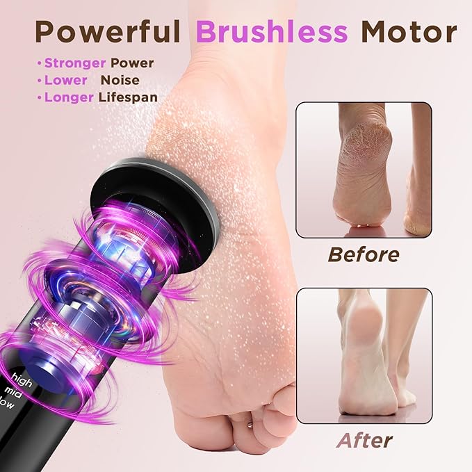 Electric Foot Callus Remover with Nano-Glass Head & 60Pcs Sandpaper Discs, 3 Hours Run Time, Electric Callus Remover for Feet with 3 Adjustable Speeds, Pedicure Tools for Dry Dead Skin Cracked Heels