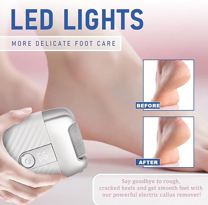 Electric Foot File with 2 Speeds & LED Display, Rechargeable Callus Remover with 3 Grit Heads (Coarse/Medium/Fine), Pedicure Tools for Feet Hard Skin Smooth Polishing (White)