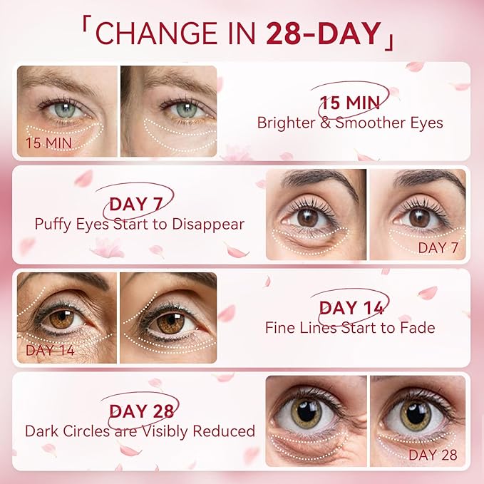 BREYLEE Rose Eye Mask– 60 Pcs, Under Eye Patches, Patches For Puffy Eyes,Hydrates, Improves And Firms The Eye Area, Suitable For Both Women And Men.