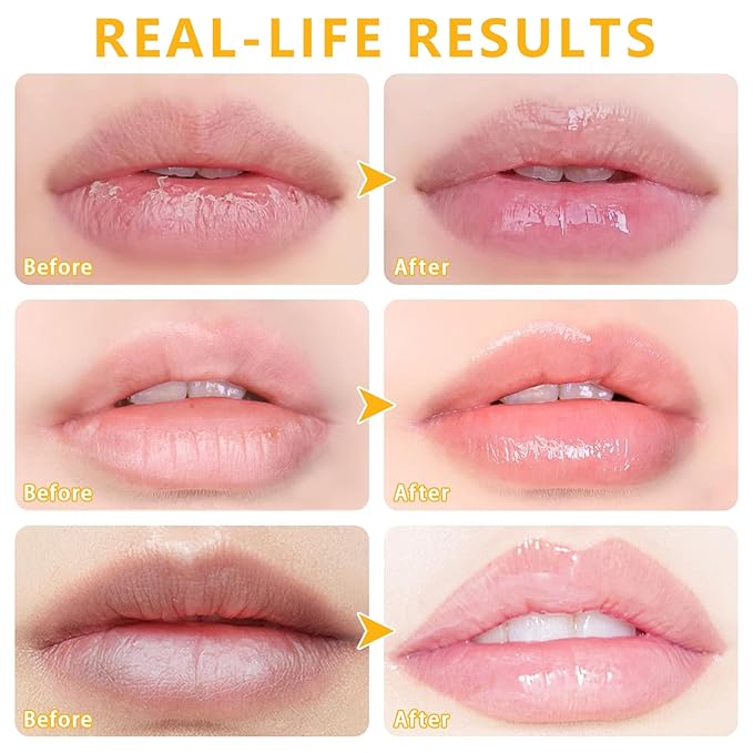 5 PCs Bee Balm Lip Mask, Moisturizing Lip Balm & Scrubs, Hydrating, Prevents Dry & Cracked Lips - Strawberry & Watermelon Flavors