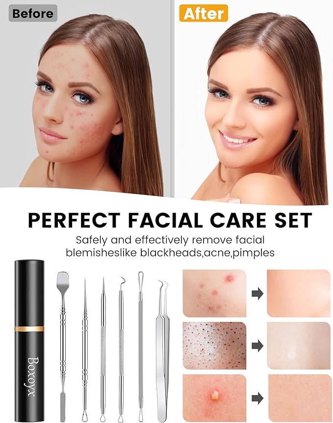 Pimple Popper Tool Kit - Boxoyx 10 Pcs Blackhead Remover Comedone Extractor Kit with Box for Quick and Easy Removal of Pimples, Blackheads, Zit Removing, Forehead,Facial and Nose (New Silver)