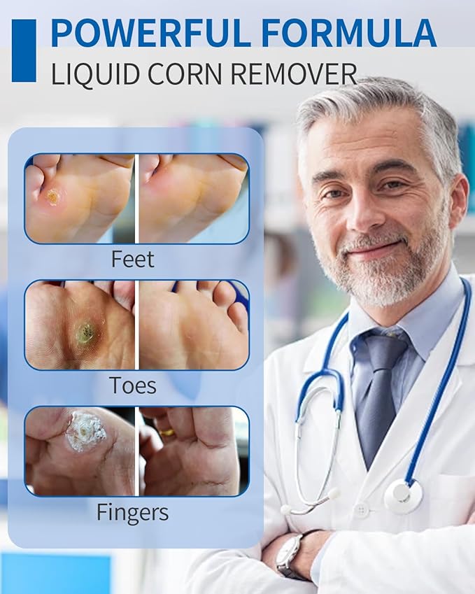 MQ Professional Corn & Callus Remover Liquid for Feet & Toes – Fast Acting for Corn Removal, Hard Skin & Dead Skin – Includes 15ML Solution + 15 Cushions + 10 Swabs – Effective Foot Care Solution