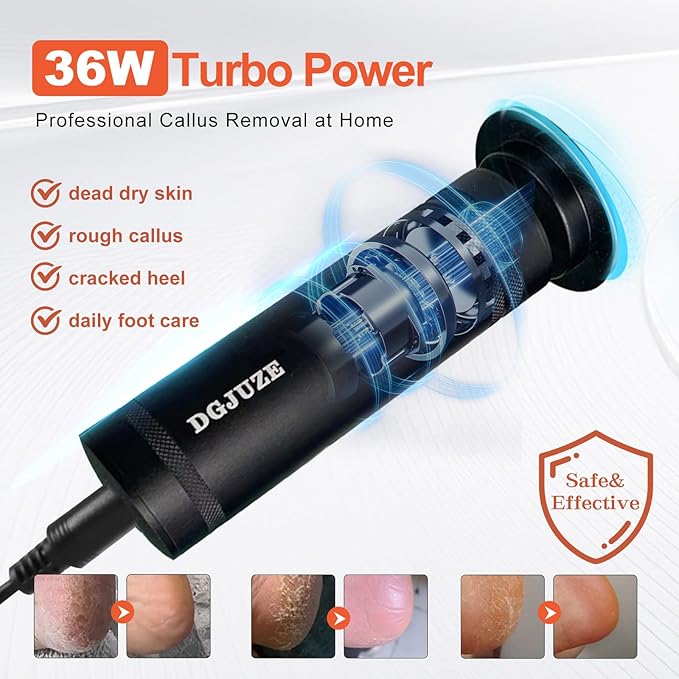 PowerPro Electric Foot Callus Remover,36W Professional 1200rpm Heavy Duty Metal Grinder for Dead Skin Automatic Foot Sander with 60pcs Sandpaper Pads for Home Use Pedicure Tool(Black)