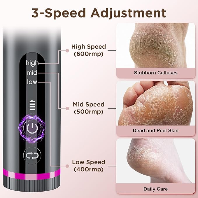 Electric Foot Callus Remover with Nano-Glass Head & 60Pcs Sandpaper Discs, 3 Hours Run Time, Electric Callus Remover for Feet with 3 Adjustable Speeds, Pedicure Tools for Dry Dead Skin Cracked Heels