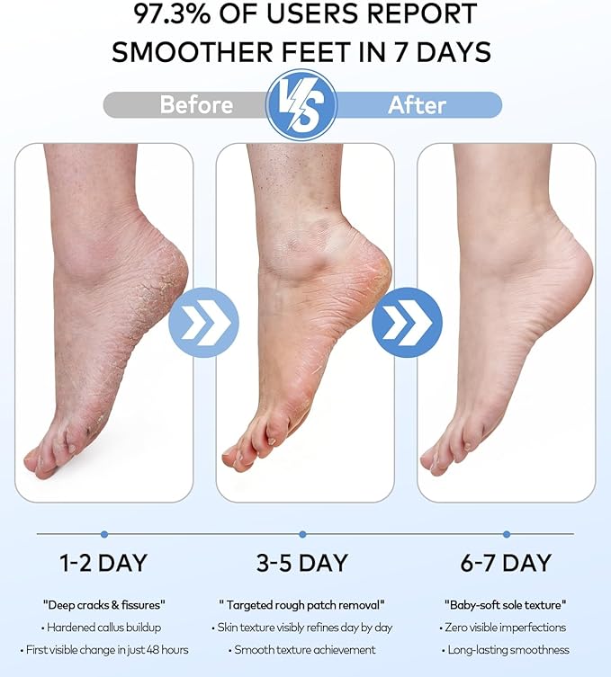 Rechargeable Electric Callus Remover for Feet with Vacuum, Pumice Stone Foot File for 100% Full Foot Care Coverage, 2-Speed & 3 Grinding Heads, Ideal Gift for Dead, Hard Cracked Dry Skin, Black