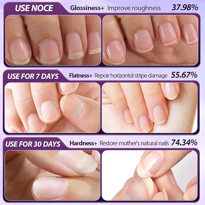 3Pcs Cuticle Oil Pusher Pen Set, 2-in-1 Ceramic Cuticle Pushers Pusher & Oil Pen, Nail Care Pens for Manicure & Pedicure, Hangnails, Dry & Damaged Nails