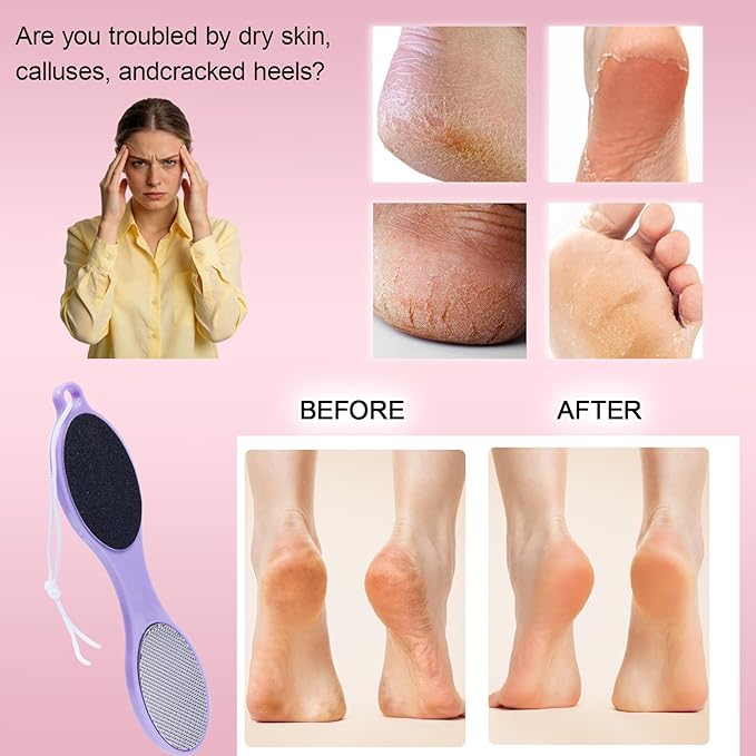 4-Sided Nano Glass Foot Callus Remover, Professional Foot File (Glass, Rasp & Sand Paper), Durable Foot Scrubber Pedicure Tools for Hard Dead Skin Remover, Soft Smooth Feet, 2 Pcs Purple