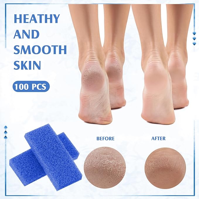 Batiyeer 100 Pcs Pumice Stone for Feet Scrubber Dead Skin Disposable Foot Pumice Foot Shower Scrubber Foot Scrubber for Heel Cuticle Callus Remover Bath Spa (Blue)