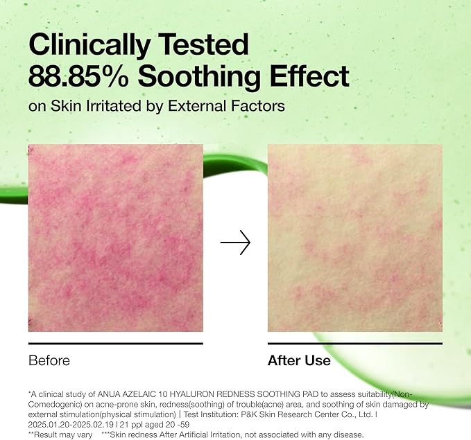 ANUA Azelaic Acid 10 Hyaluronic Acid Soothing Toner Pads, Hydrating Facial Mask for Redness, Pore & Blemish Care, Quick & Easy Stretchable Formula, Korean Skincare, 90 Pads