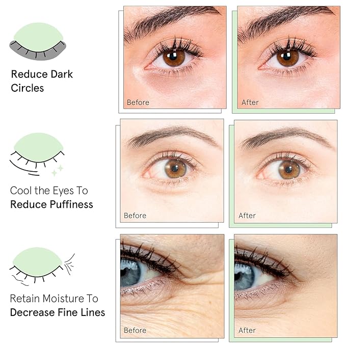 QUIA Hydrogel Eye Patches with Collagen – Depuff, Smooth Fine Lines & Hydrate in 15 Minutes – No-Slip, Soothing Formula – 20 Pairs for All Skin Types