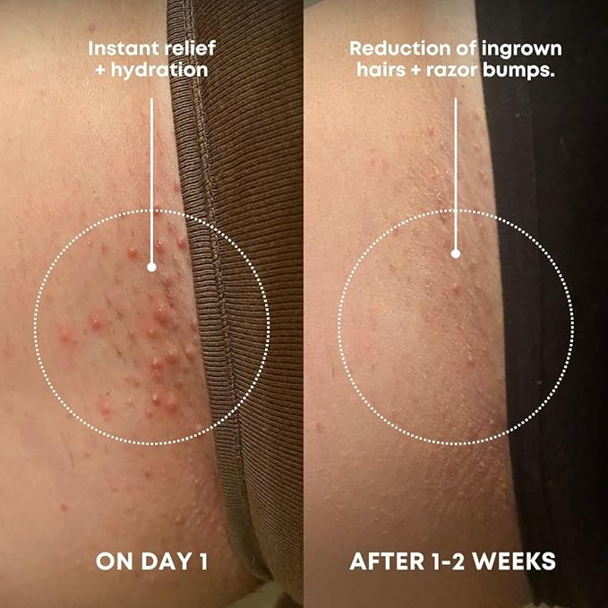 Bushbalm Ingrown Hair Exfoliating Scrub - Reduces Appearance of Ingrown Hairs and Razor Bumps, Soothes Skin and Post-Shave Redness - Nude, 236 ml