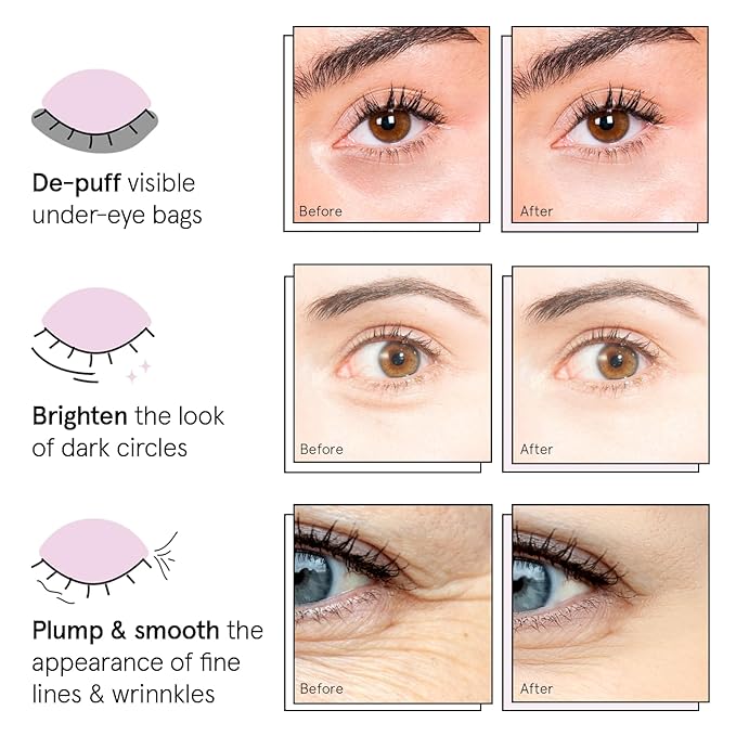 grace & stella Under Eye Patches (12 pairs) Eye Masks for Dark Circles and Puffiness - Gifts for Mom, Self Care Gifts, Bridal Shower Gifts, Eye Patches for Women - Vegan Cruelty-Free Skin Care