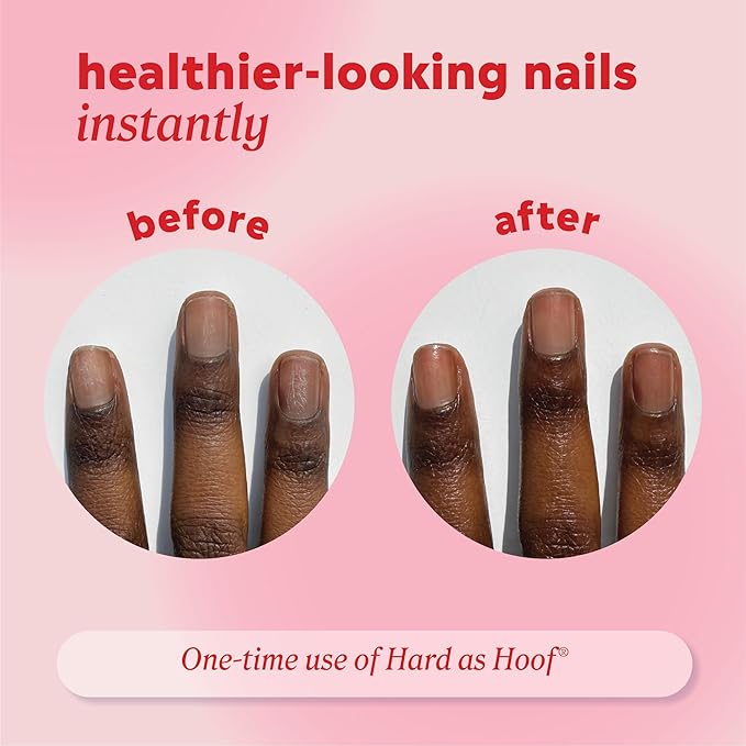 Onyx Professional Hard as Hoof Nail Strengthening Cream, Shea Butter Scent - Nail Growth & Conditioning Cuticle Cream Stops Splits, Chips, Cracks & Strengthens Nails, 1 oz